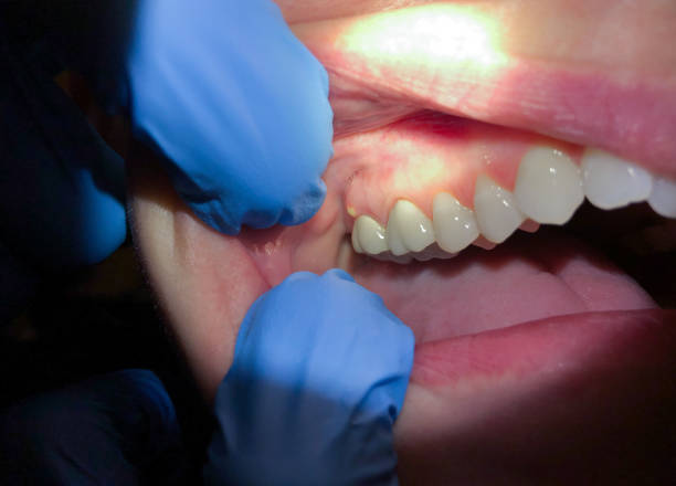 Best Emergency TMJ Treatment in Tonka Bay, MN