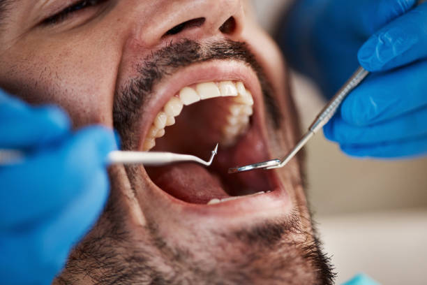 Best Urgent Care for Lost Fillings or Crowns in Tonka Bay, MN